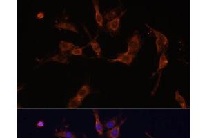 Immunofluorescence analysis of C6 cells using IQGAP1 Polyclonal Antibody at dilution of 1:100 (40x lens). (IQGAP1 抗体)