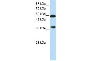 WB Suggested Anti-ARID3B  Antibody Titration: 0. (ARID3B 抗体  (C-Term))