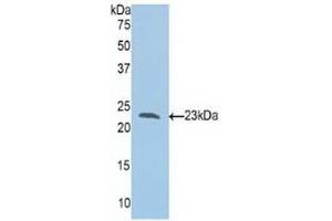 Detection of Recombinant Slit1, Human using Polyclonal Antibody to Slit Homolog 1 (Slit1) (SLIT1 抗体  (AA 647-835))