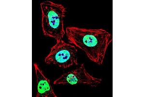 Fluorescent confocal image of Hela cell stained with HDAC2 Antibody (Center) (ABIN653718 and ABIN2843029). (HDAC2 抗体  (AA 410-439))
