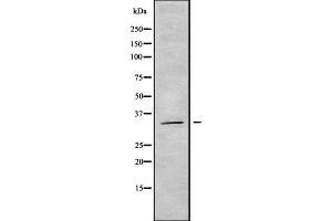 Western blot analysis OR5AT1 using COLO205 whole cell lysates (OR14A16 抗体  (Internal Region))