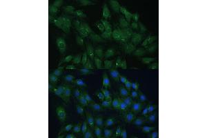 Immunofluorescence analysis of C6 cells using  Polyclonal Antibody (ABIN7265476) at dilution of 1:100 (40x lens). (ARL1 抗体  (AA 62-181))