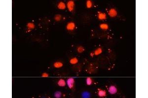 Immunofluorescence analysis of HeLa cells using HMGB2 Polyclonal Antibody at dilution of 1:100. (HMGB2 抗体)