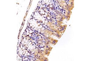 Immunohistochemistry (Paraffin-embedded Sections) (IHC (p)) image for anti-Signal Recognition Particle 14kDa (Homologous Alu RNA Binding Protein) (SRP14) antibody (ABIN7075596)