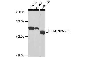 Western blot analysis of extracts of various cell lines, using PMP70/ Rabbit mAb (ABIN1683181, ABIN3018647, ABIN3018648 and ABIN7101638) at 1:1000 dilution. (CX3CL1 抗体)