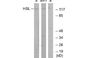Immunohistochemistry analysis of paraffin-embedded human tonsil tissue using HSL (Ab-552) antibody. (LIPE 抗体  (Ser552))