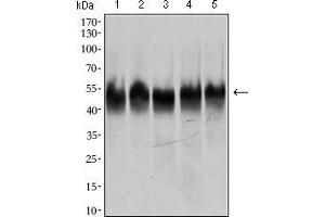 Western blot analysis using TUBB2A mouse mAb against HeLa (1), A549 (2), HEK293 (3), Jurkat (4) and PC-12 (5) cell lysate. (TUBB2A 抗体  (AA 25-187))