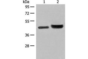 Western blot analysis of 231 cell and Human fetal liver tissue lysates using INPP1 Polyclonal Antibody at dilution of 1:500 (INPP1 抗体)