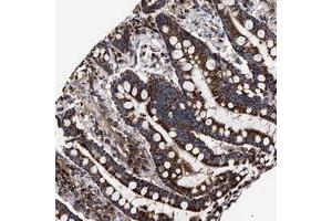 Immunohistochemical staining of human colon with COG5 polyclonal antibody  shows strong cytoplasmic positivity in granular pattern in glandular cells. (COG5 抗体)