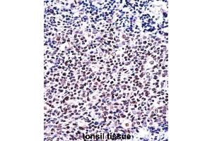 Immunohistochemistry (IHC) image for anti-Nuclear Factor of Activated T-Cells, Cytoplasmic, Calcineurin-Dependent 1 (NFATC1) antibody (ABIN2997610) (NFATC1 抗体)