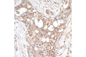 anti-Family with Sequence Similarity 82, Member A2 (FAM82A2) (AA 300-350) antibody