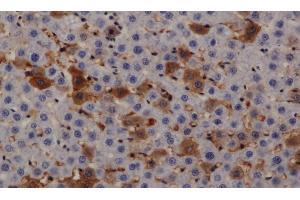Immunohistochemistry of paraffin-embedded Rat liver using PRKD3 Polyclonal Antibody at dilution of 1:200 (PRKD3 抗体)