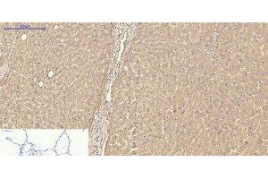 Immunohistochemistry of paraffin-embedded Human lung tissue using TTR Monoclonal Antibody at dilution of 1:200. (TTR 抗体)