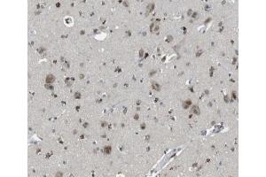 ABIN6266846 at 1/100 staining human brain tissue sections by IHC-P. (TFAM 抗体  (Internal Region))