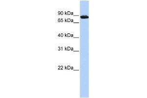 WB Suggested Anti-HTATSF1 Antibody Titration: 0. (HTATSF1 抗体  (Middle Region))