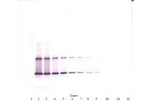 Image no. 1 for anti-Ciliary Neurotrophic Factor (CNTF) antibody (ABIN1497554) (CNTF 抗体)