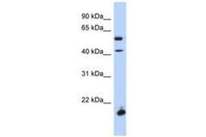 Image no. 1 for anti-Developing Brain Homeobox 1 (DBX1) (AA 248-297) antibody (ABIN6741082) (DBX1 抗体  (AA 248-297))