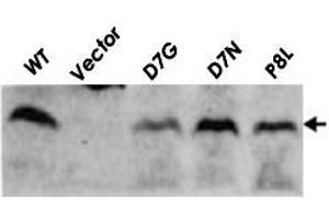 Detection of RuvC (19kD) proteins in the cell extracts of E. (RuvC 抗体)