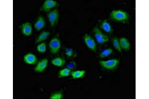Immunofluorescent analysis of A549 cells using ABIN7163717 at dilution of 1:100 and Alexa Fluor 488-congugated AffiniPure Goat Anti-Rabbit IgG(H+L) (PLXND1 抗体  (AA 1-222))