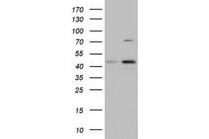 HEK293T cells were transfected with the pCMV6-ENTRY control (Left lane) or pCMV6-ENTRY CBWD1 (Right lane) cDNA for 48 hrs and lysed. (CBWD1 抗体)