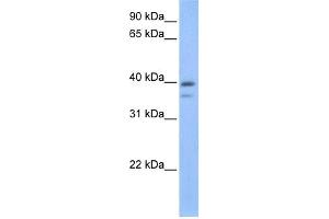 WB Suggested Anti-VPS26B Antibody Titration: 0. (VPS26B 抗体  (C-Term))
