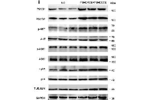 PSMD1 and PSMD2 regulate the expression level of fatty acids (FAs) and lipid synthesis-related genes. (MAPK14 抗体  (pThr180, pTyr182))