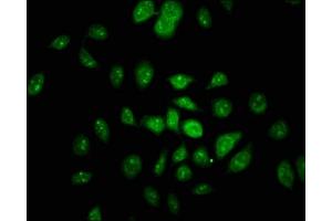 Immunofluorescence staining of A549 cells with ABIN7161270 at 1:100, counter-stained with DAPI. (Neurofibromin 1 抗体  (AA 655-892))