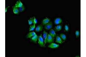Immunofluorescent analysis of A549 cells using ABIN7147247 at dilution of 1:100 and Alexa Fluor 488-congugated AffiniPure Goat Anti-Rabbit IgG(H+L) (CADM3 抗体  (AA 140-328))