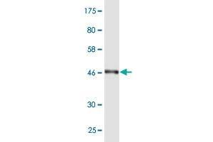 Western Blot detection against Immunogen (48. (RAB7L1 抗体  (AA 1-203))