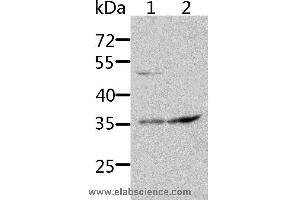 Western blot analysis of HT-29 and 231 cell, using SOCS1 Polyclonal Antibody at dilution of 1:1700 (SOCS1 抗体)
