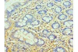 Immunohistochemistry of paraffin-embedded human small intestine tissue using ABIN7148385 at dilution of 1:100 (Complement Factor H 抗体  (AA 20-270))