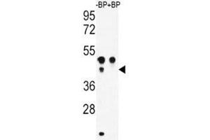 Western blot analysis of ATF4 antibody pre-incubated without (Lane 1) and with (2) blocking peptide in WiDr lysate (ATF4 抗体  (AA 220-252))