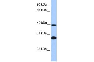 WB Suggested Anti-UBE2F Antibody Titration: 0. (UBE2F 抗体  (N-Term))