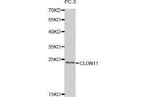 Western blot analysis of extracts of PC-3 cell line, using CLDN11 antibody. (Claudin 11 抗体  (AA 26-207))