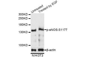 Western blot analysis of extracts of NIH/3T3 cells,using Phospho-eNOS-S1177 antibody (ABIN5995597) at 1/1000 dilution. (ENOS 抗体  (pSer1177))
