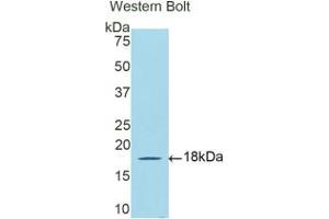 Western blot analysis of the recombinant protein. (DBR1 抗体  (AA 243-372))