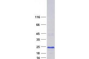 Western Blotting (WB) image for CCHC-Type Zinc Finger, Nucleic Acid Binding Protein (CNBP) (Transcript Variant 6) protein (Myc-DYKDDDDK Tag) (ABIN2712904)