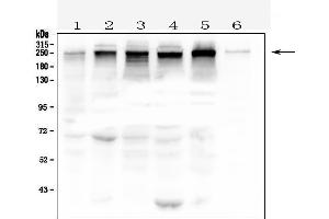 Western blot analysis of TJP1 using anti- TJP1 antibody . (TJP1 抗体  (AA 1178-1527))
