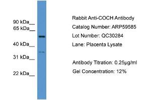 WB Suggested Anti-COCH  Antibody Titration: 0. (COCH 抗体  (N-Term))