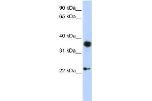 WB Suggested Anti-EN1 Antibody Titration:  0. (EN1 抗体  (C-Term))