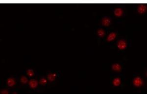 Immunofluorescence (fixed cells) (IF/ICC) image for anti-SRY (Sex Determining Region Y)-Box 9 (SOX9) antibody (ABIN6265242)