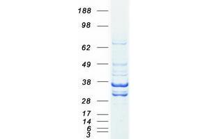 Western Blotting (WB) image for Lactate Dehydrogenase B (LDHB) protein (Myc-DYKDDDDK Tag) (ABIN2724574)