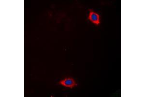 Immunofluorescent analysis of Laminin alpha 4 staining in Hela cells. (LAMa4 抗体  (Center))
