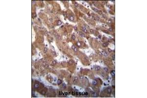 Immunohistochemistry (Paraffin-embedded Sections) (IHC (p)) image for anti-Harakiri, BCL2 Interacting Protein (Contains Only BH3 Domain) (HRK) (AA 15-50) antibody (ABIN388104)