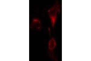 ABIN6275584 staining  A549 cells by IF/ICC. (SLC9A9 抗体  (Internal Region))
