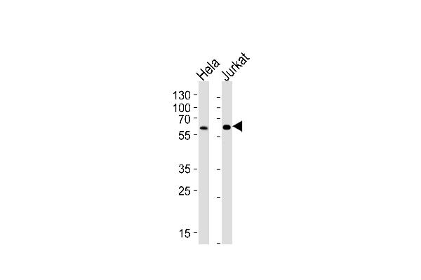 Heparanase 2 抗体  (C-Term)