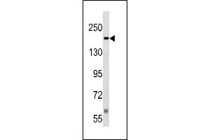 TSC2 Antibody (Center /) (ABIN1881944 and ABIN2843242) western blot analysis in Jurkat cell line lysates (35 μg/lane). (Tuberin 抗体  (AA 1364-1393))