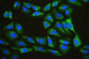IF analysis of EIF4A using anti-EIF4A antibody (ABIN7601309).