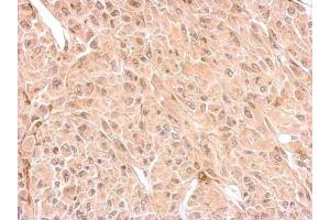 IHC-P Image CNP antibody detects CNP protein at cytosol on U87 xenograft by immunohistochemical analysis. (Cnpase 抗体)