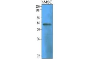 Western Blotting (WB) image for anti-5'-Nucleotidase, Ecto (CD73) (NT5E) (AA 27-252) antibody (ABIN316595) (CD73 抗体  (AA 27-252))